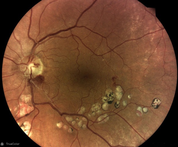 DRSplus-retina_web-1080x720-1-768x512