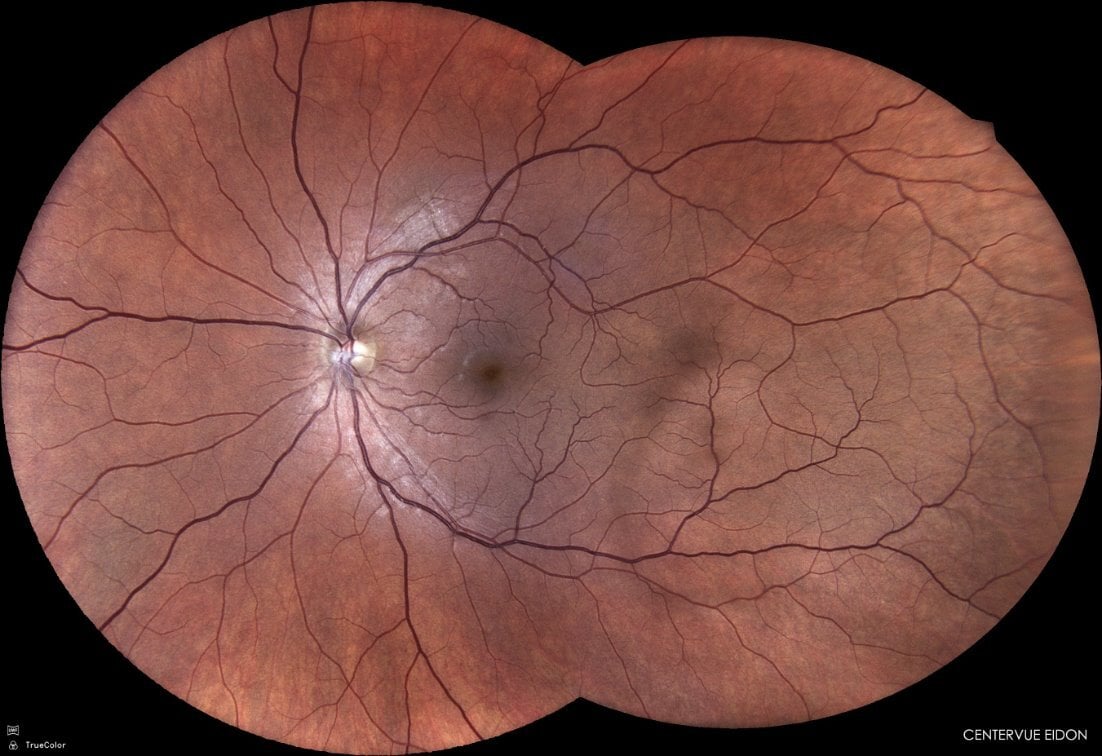 eidon 2 shot eidon 2 shot